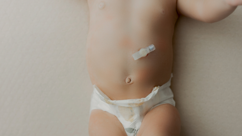 Navigating Life with a G-Tube- A Comprehensive Guide to Care and Feeding - Eclipse Regenesis Featured IMG Navigating Life with a G-Tube- A Comprehensive Guide to Care and Feeding - Eclipse Regenesis Featured IMG