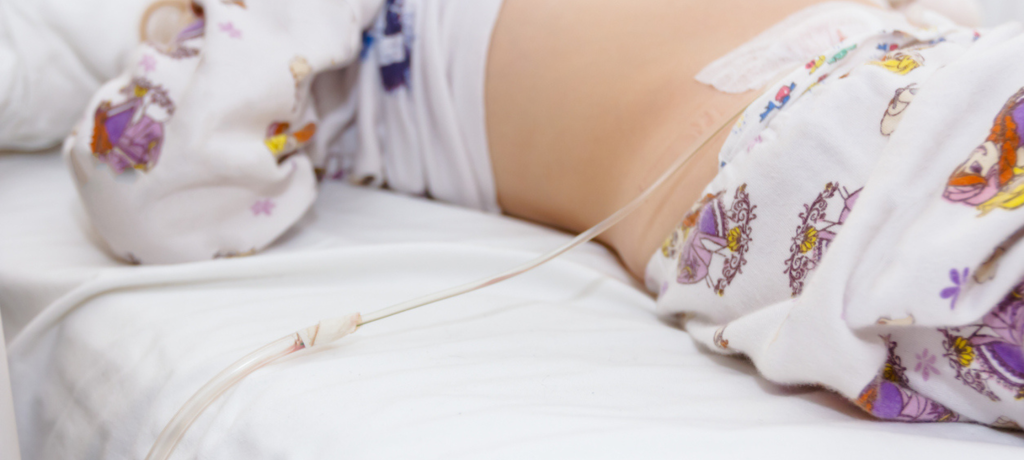 Comparing Treatment Options for SBS_ Surgery, Medications, Transplant, and Regenerative Medicine - Eclipse Regenesis Blog Featured IMG